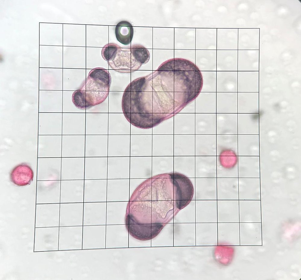 Gran- (stora) och  tallpollen (mindre) med luftblåsor samt några små rosa ekpollen i ljusmikroskop. Foto: Pia Östensson